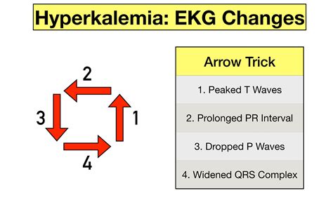 Hyperkalemia ECG Changes Findings And Progression Of Effects On The