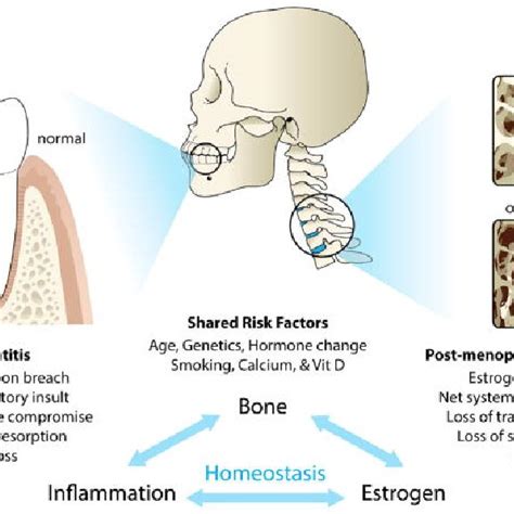 Pdf Periodontal Management In Osteoporosis Patients