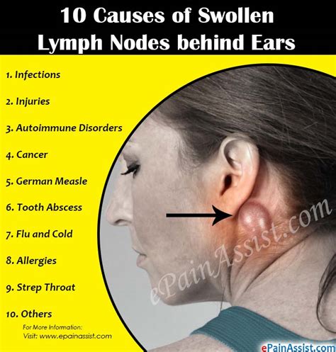 Swollen Lymph Nodes Behind Ear Cancer Causes Symptoms My XXX Hot Girl