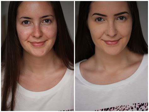 Hier erfährst du pickelmale entfernen mit dem dermaroller was sind pickelmale und wie entstehen sie? beautyelfe: Foundation-Routine: Schnell, aber effektiv!