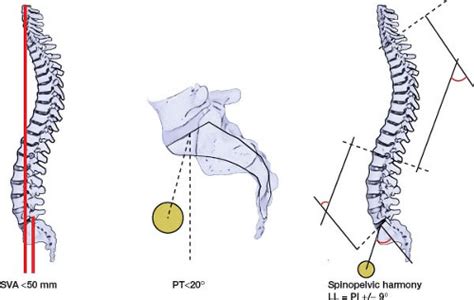 Spinal Biomechanics Musculoskeletal Key