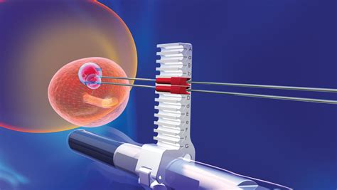 Targeted Prostate Biopsy Olympic Diagnostic