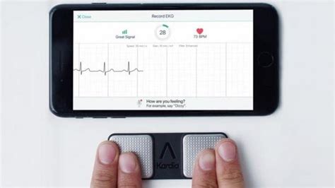 這款心臟病檢測智慧型手機應用的準確率幾乎能跟傳統ecg持平 每日頭條