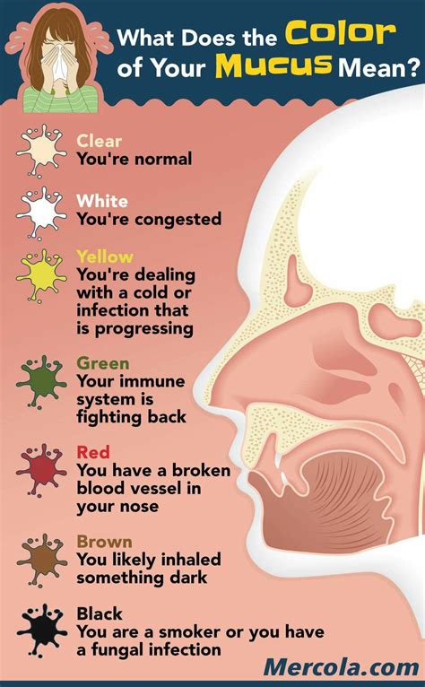 Diagram Of Sinuses And Chart Of Mucus Colors Healthcaretips In 2020 Snot Or Not An Infographic