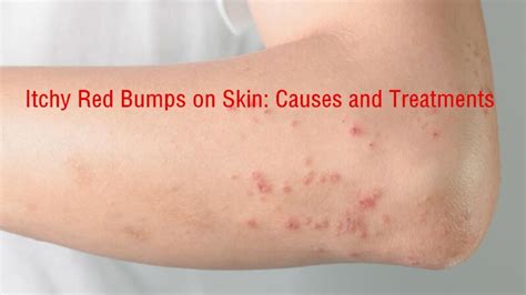 Red Spots On Your Skin That Itch Tbmtb