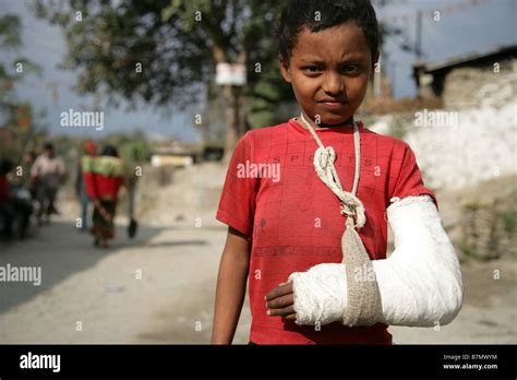 Boy With Arm In Cast Hi Res Stock Photography And Images Alamy