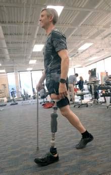 Veterans Stand And Walk After First Of Its Kind Prosthesis Surgery In Utah The Salt Lake Tribune
