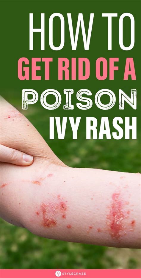 How To Get Rid Of A Poison Ivy Rash Here Are Some Of The Best And Most Effective Natural