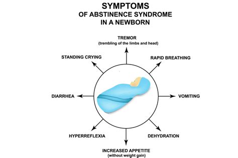 Neonatal Abstinence Syndrome Symptoms Causes And Treatment By Dr Lathiesh Kumar Kambham