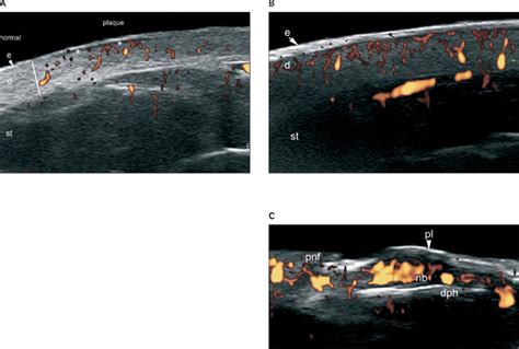 Common Applications Of Dermatologic Sonography Wortsman 2012