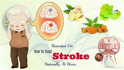 29 Remedies On How To Treat Stroke Naturally At Home Remedies