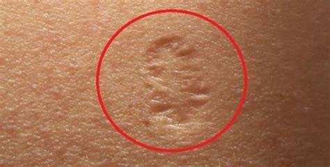 Do You Know The Truth Behind The Small Scar On