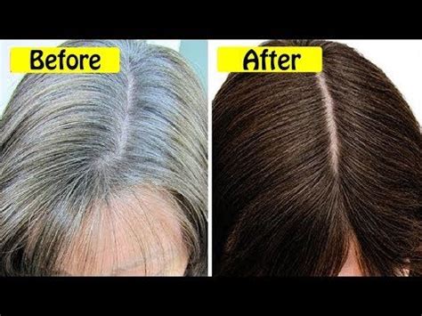 Is there a physiological process through which extreme stress can cause hair to change colour this fast? 60 Years Old White Hair Cured In 1 Day, Turn White Hair ...