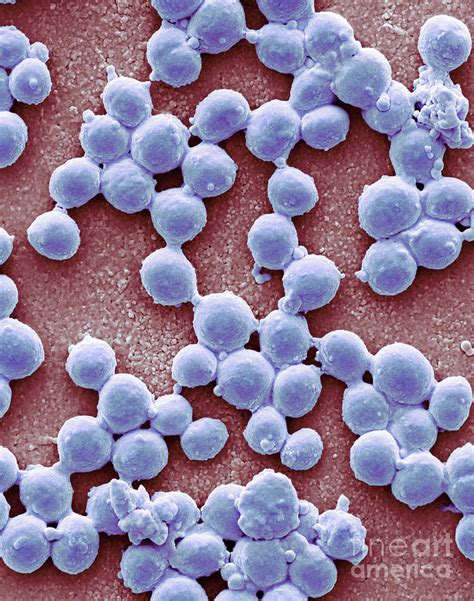 Group A Streptococcus Bacteria Photograph By Steve Gschmeissnerscience