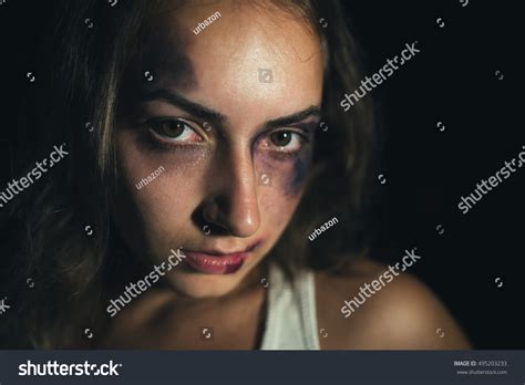 Close Up Of A Beaten Face Of A Caucasian Woman With Worried Look On Her