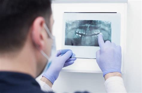 Get To Know Your Southlake Oral Surgeon Wisdom Teeth Dental Implants Colleyville Oral Surgeon