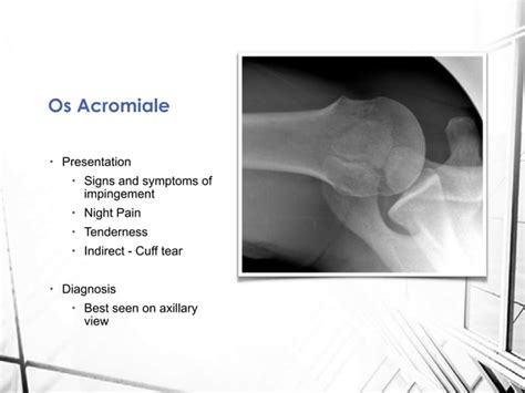 Acromion Os Acromiale Fractures And Insufficiency