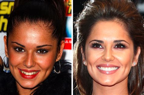 33 Before And After Photos That Prove Good Teeth Can