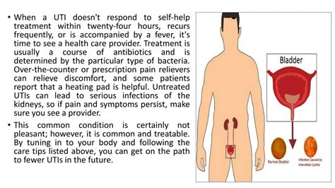 Ppt Ouch Burning Pee Is This A Urinary Tract Infection Treatment