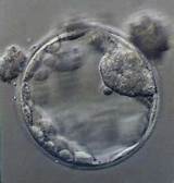 Photos of Best Ivf Clinics In Florida
