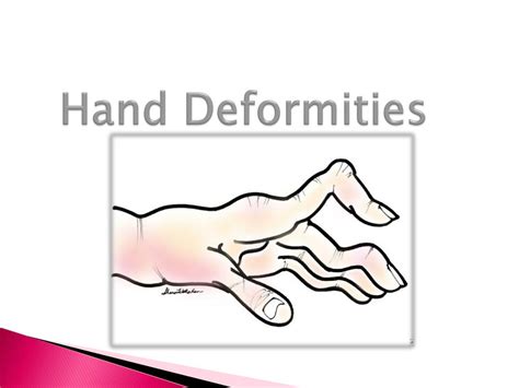 Ppt Pathologies Of The Hand Powerpoint Presentation Free Download