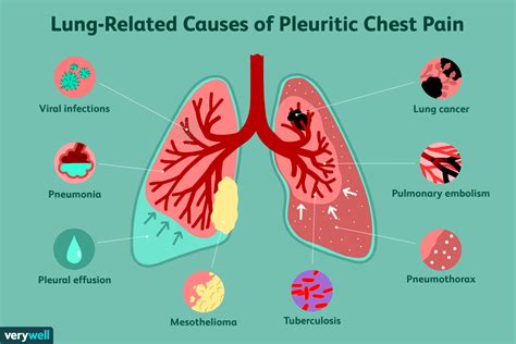 What Causes Sharp Pain In Chest