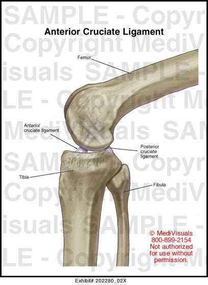 Anterior Cruciate Ligament Medical Illustration Medivisuals