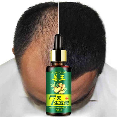 While it has a number of other benefits, most people take this supplement to strengthen the hair while increasing the length. Aliexpress.com : Buy 30ml/bottle Hair Growth Essence ...