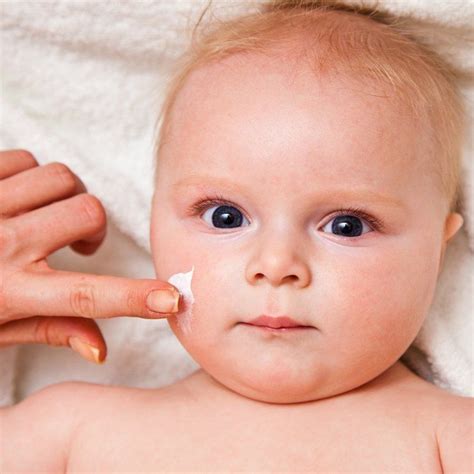 Womens Health On Twitter Baby Acne Baby Acne Treatment Baby Eczema