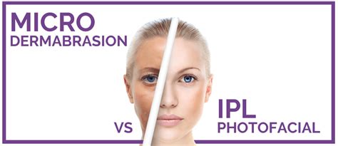 Microdermabrasion Vs Ipl Photofacial Whats The Difference Eureka