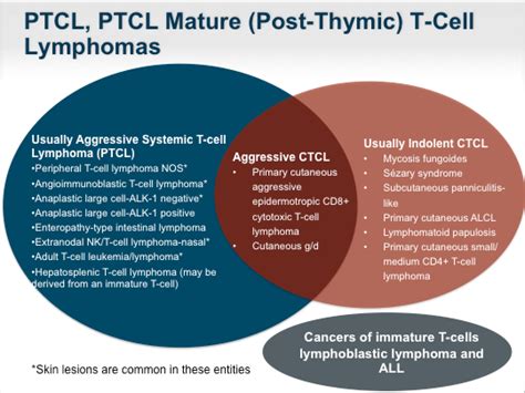 Peripheral T Cell Lymphoma In 2013