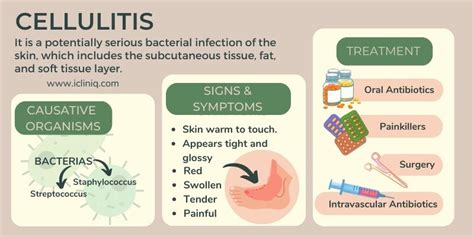 Cellulitis Causes Symptoms Risks Diagnosis Treatment Home