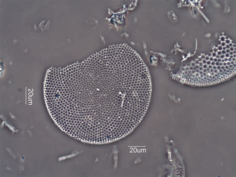 Diatomaceous Earth Celite 535 Under The Microscope