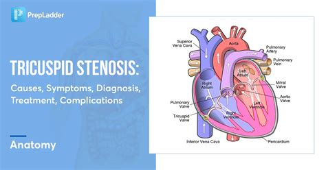 Tricuspid Stenosis Causes Symptoms Diagnosis Treatment Complications