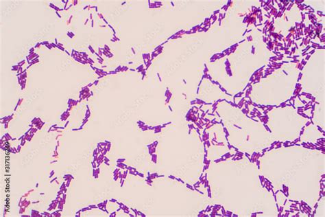 Stockfoto Bacillus Gram Positive Stain Under Microscope View Bacillus