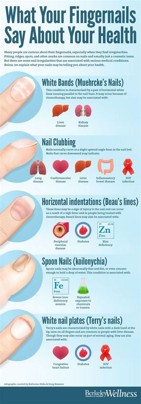 Trauma or a local disease affecting the nail fold can also cause beau's lines. With hypothyroidism, are the finger nail ridges you get ...