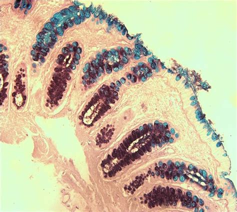 Section Of Healthy Mucosal Biopsy Stained By Hid Ab At Magnification