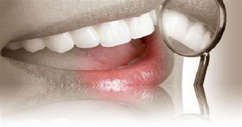 Odontología Conservadora Y Preventiva Nuestros Tratamientos De Clínica