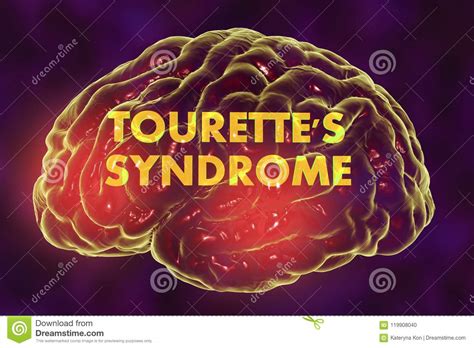 Tourette S Syndrome Medical Concept Stock Illustration Illustration Of Title Therapy
