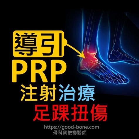 Homepage Mb Case070 Echo Guided Prp Injection For Ankle Sprain Ligament