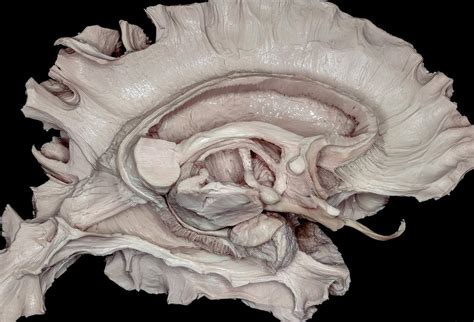 Mid Brain Anatomy