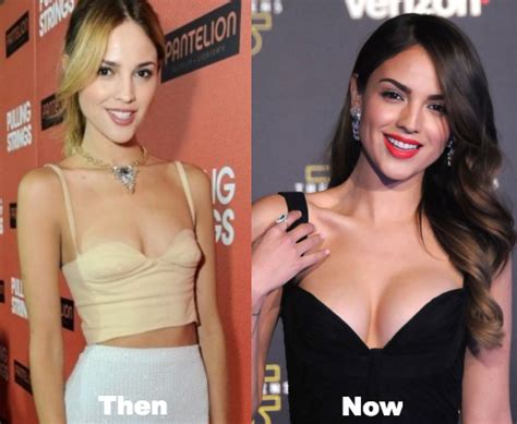 Eiza Gonzalez Plastic Surgery Before And After Photos