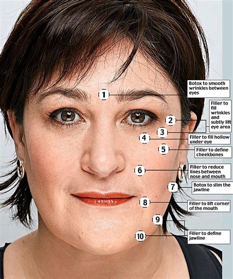 Sarah Vine Swore Shed Never Succumb To Botox But She Surrendered To