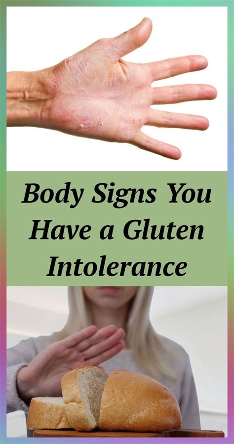 Body Signs You Have A Gluten Intolerance Gluten Intolerance Signs Of