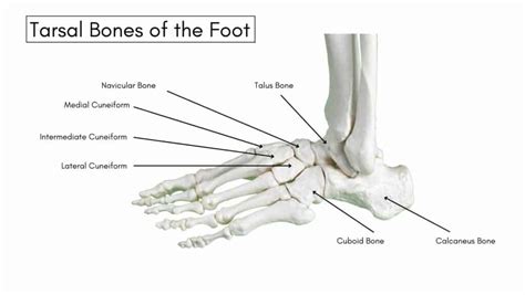 Tarsal Coalition Symptoms Diagnosis And Treatment