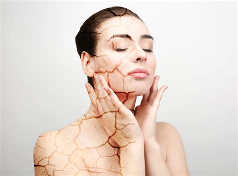 Why You Get Dry Skin And How To Treat It