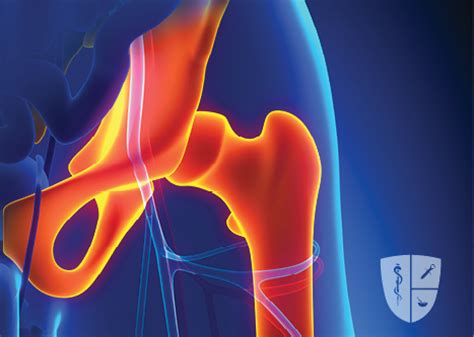 There are many possible causes of hip pain, including serious ones, like a fracture or joint infection, and ones that are less so (though still potentially debilitating). Hip Joint Injection for Pain Relief | Alabama Pain Physicians