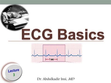 Ecg Or Ekg Sample Strips Ms Cardiovascular
