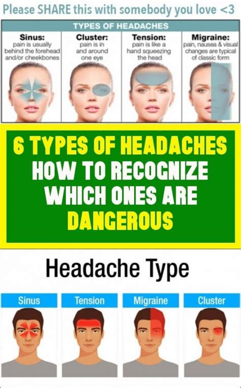 6 Types Of Headaches Recognizing Which Ones Are Dangerous In 2020