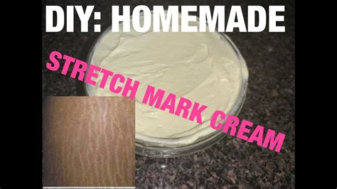Diy Homemade Stretch Mark Cream Kinesha Harry Youtube